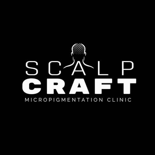 Scalp Micropigmentation SMP Rayleigh Essex