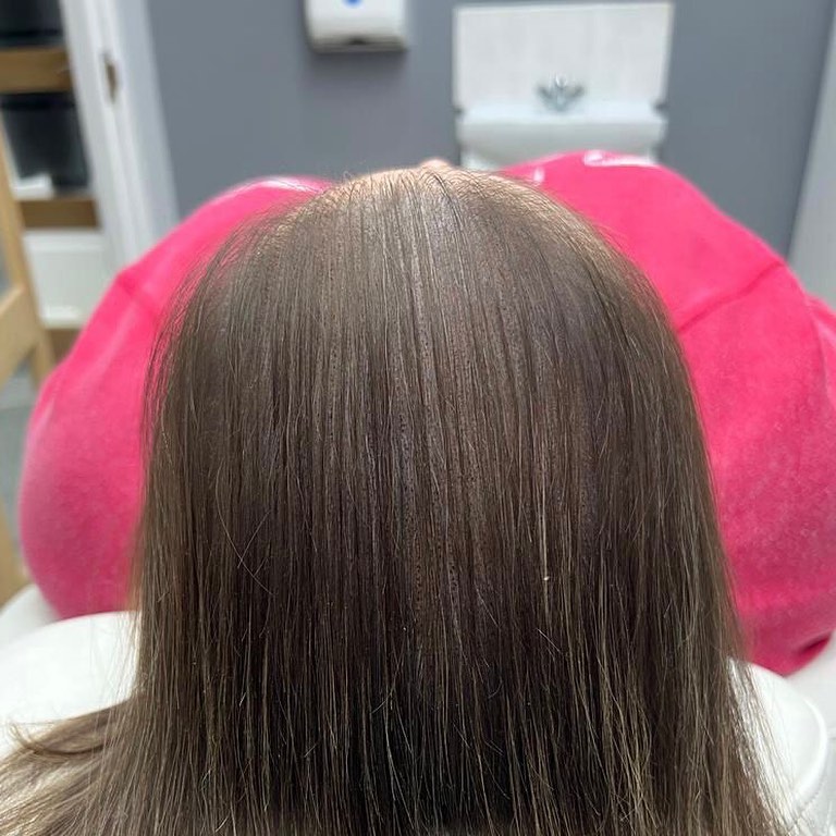 After
